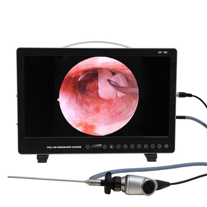 22 Inch Endoscope Camera Syste - مراجعة Laptop Accessories All In One وسعره